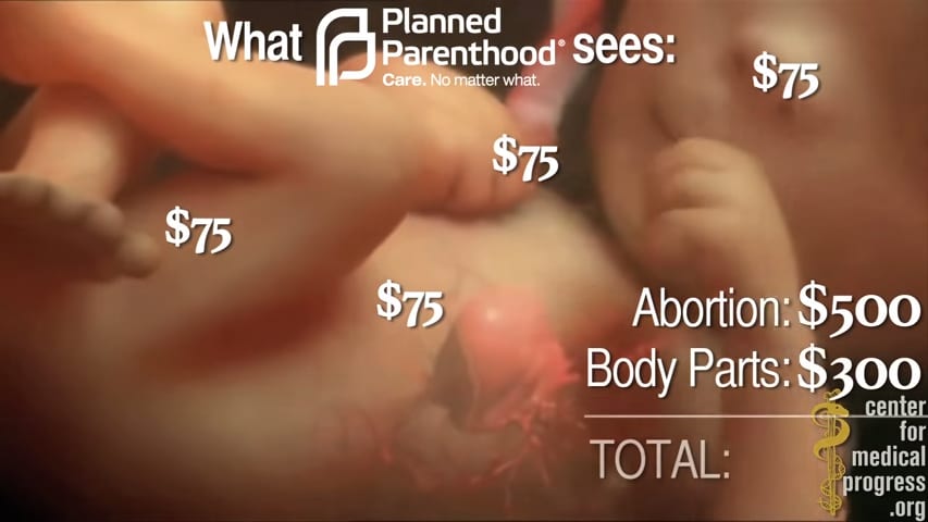 FEDERAL GOVERNMENT CAUGHT BUYING 'FRESH' FLESH OF ABORTED BABIES!